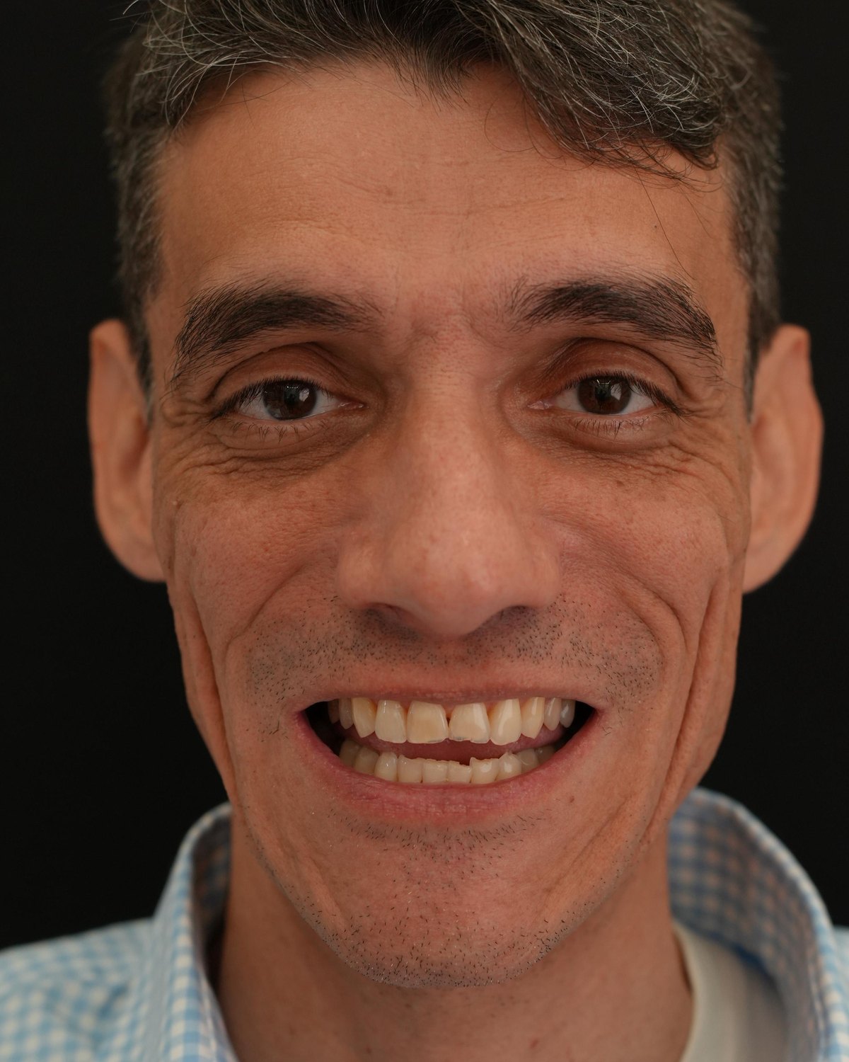 Caso 01, início